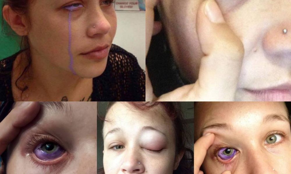 Lady let crying purple tears of agony after eyeball tattoo went wrong