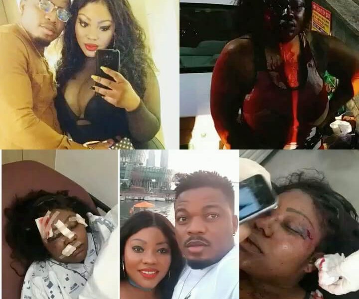 Liberian Man Who Brutalised Fiancee Weeks After Proposing Begs For 'Another Chance'