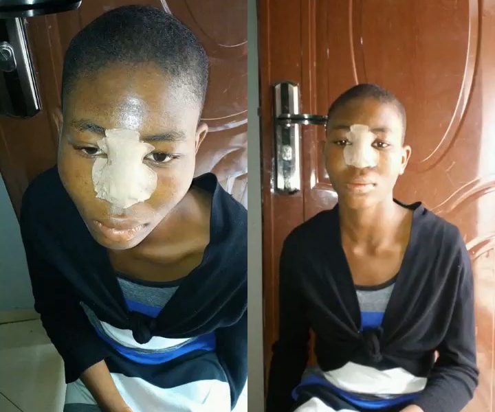 Lady uses Heeled Shoe To Break House Maid’s Nose For Not Flushing Toilet