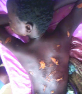 12-Year-Old Brutally Beaten And Tortured With A Hot Knife  For Stealing 50 Naira