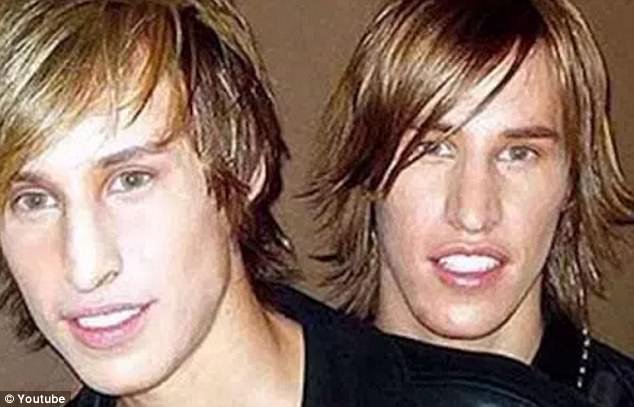 Twin Brothers Undergo Surgery To Look Like Brad Pitt
