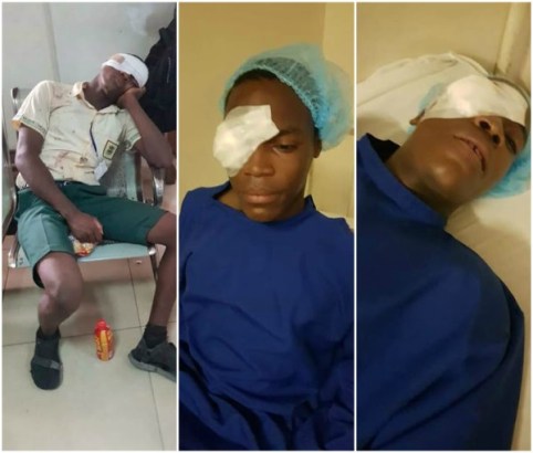 Ojodu Grammar School Student Stabbed In The Eye By Fellow Student