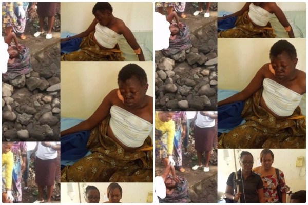 Lady Rescued After Breast And Vulva Were Harvested By Ritualists