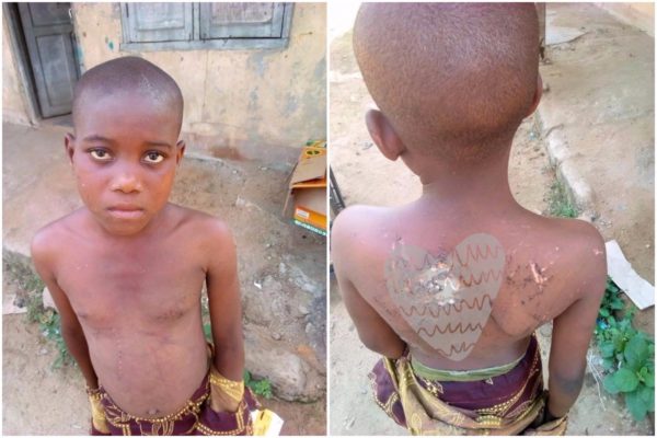 Girl Brutalized With Razor Blade By Her Cousin In Delta State