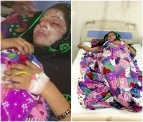Man Attacks Wife With Acid For Giving Birth To A Baby Girl