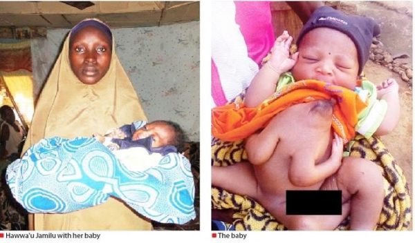 Woman Excited As She Delivers Baby With 4 Hands, 3 Legs In Kaduna
