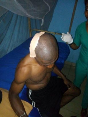 Referee Brutalized By Fans After Football Match In Imo State