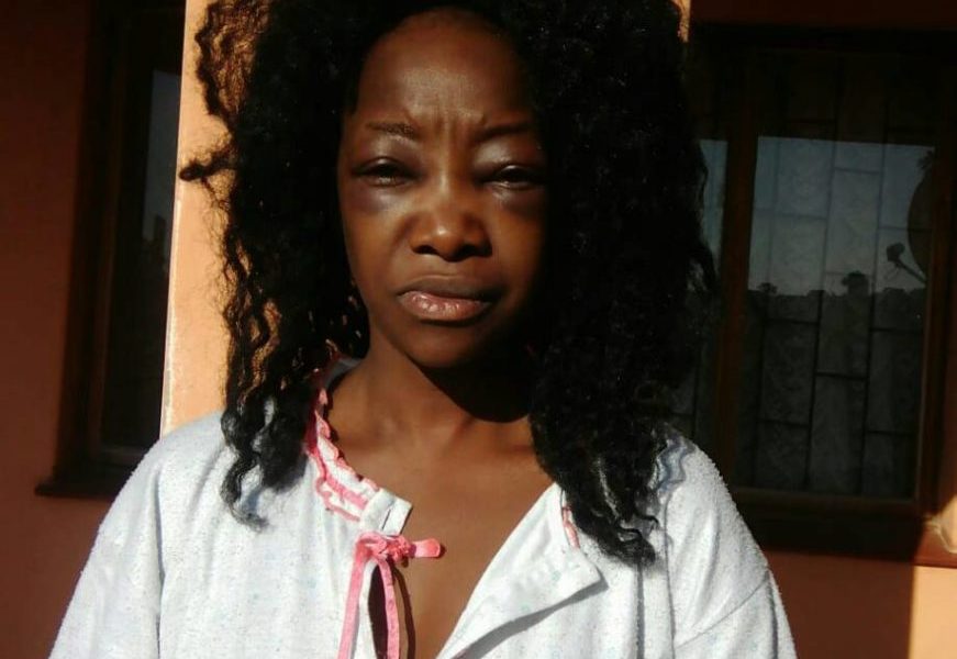 Lady shares photos of her sister who was beaten mercilessly by a taxi driver