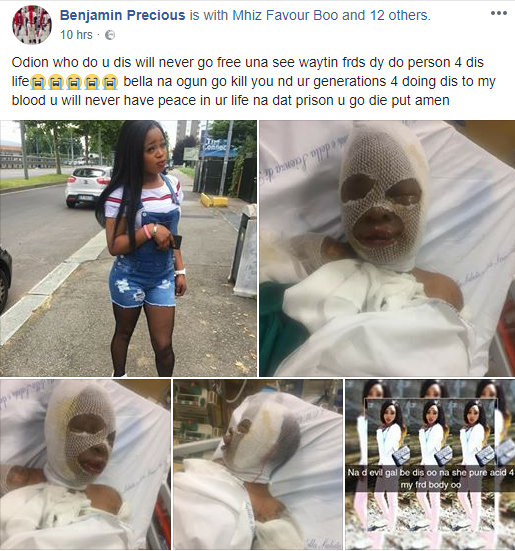 Nigerian woman identified as Odion is currently battling for her life after a fellow Nigerian lady simply identified as Bella, bathed her with acid in Torino, Italy on Sunday June 3rd. The attacker has since been arrested and the police is investigating the root cause of the attack.