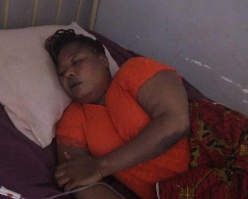 Edo State Governor’s Female Aide In Critical Condition After Been Battered By Council Officials (Photos)