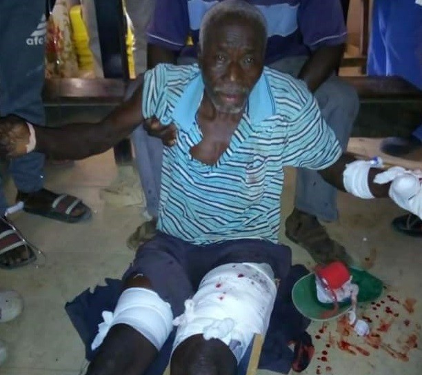 Graphic: Two Young Men Killed, Several Others Injured As Police And Villagers Clash During Anti-Polution Protest In Gambia