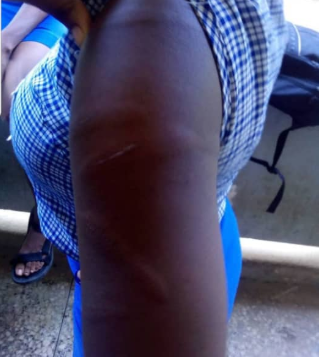 Queens College Student Beaten Brutally By Teacher For Kneeling On His Handkerchief