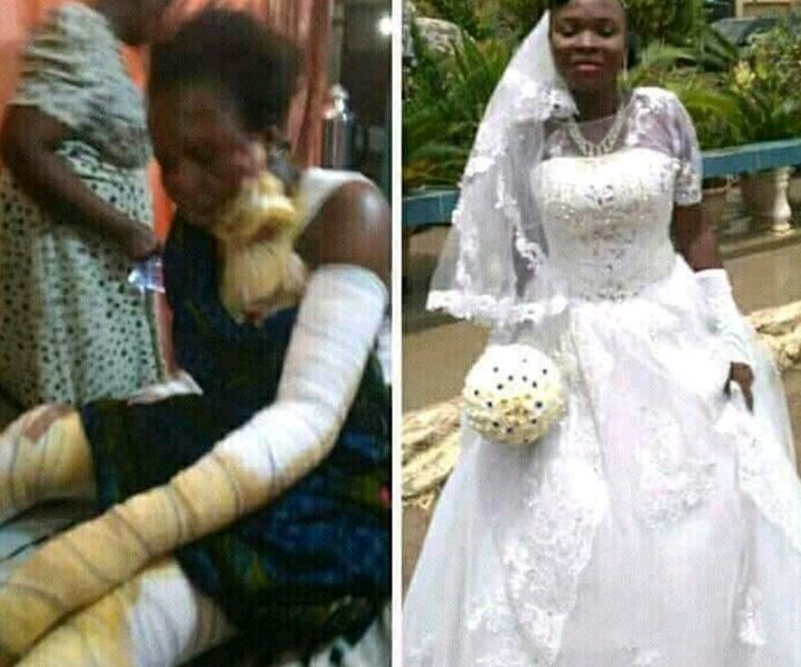 Lady Doused With Acid By Unidentified Person Just 24 Hours After Her Wedding