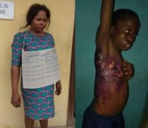 Graphic Photos: Housewife Arrested For Scalding Maid With Hot Water For Sleeping On Her Couch