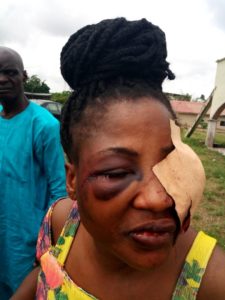 A married man has been ordered to be remanded in prison for savagely battering his girlfriend for visiting him unannounced in Osun state. 25-year-old man identified as Olusola Simeon, has been arraigned and convicted by a Magistrate court sitting in Osogbo, the Osun State capital for beating and inflicting injuries on his girlfriend, Fadunsi Alaba. Simeon admitted guilty of the crime of assault, leveled against him by the police when he was arraigned on Tuesday. The Prosecutor, Jafani Muslim, told the court that the convict committed the offence of assault on July 2, 2018 at about 9.15 pm at Agowande Area, Osogbo. Fadunsi Alaba. He said the convict inflicted injuries in his girlfriend of about six years, thus committed a crime that contravened section 355 of the criminal Code Cap 34 Vol 11, Laws of Osun State, 2003. The victim, Alaba, was said to have gone to the convict’s house with intention of living with him after six years of dating. The prosecution said the action of the victim infuriated the convict because of his wife and kids she met at home, hence the reason for beaten her. The Magistrate, Mrs Awodele Modupe Adedoyin, found Simeon guilty and ordered that he be remanded in Ilesha prison custody. She latter adjourned the case to August 3, for sentencing.