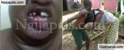 Man Arraigned In Court For Knocking Off Teeth Of Sex Worker (See Reason)