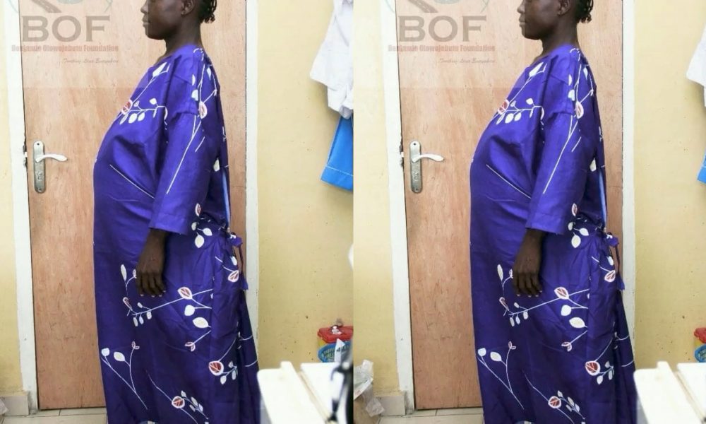 Viewer Discretion: See What Was Removed From Stomach Of Woman Who Appeared Pregnant For 9 Years