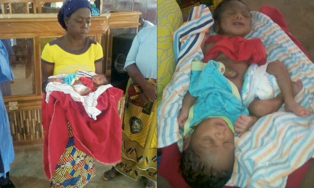 Photos: Benue Woman Gives Birth To Conjoined Twins