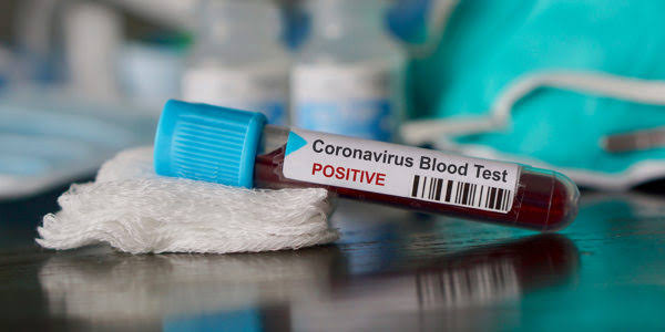 Tests positive for coronavirus
