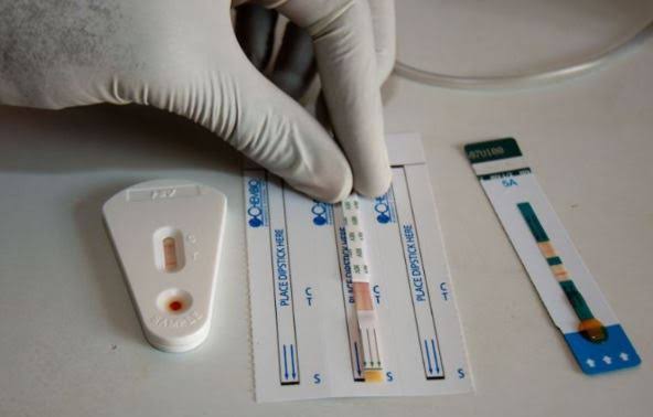 FG Launches New Rapid Test Kit For HIV