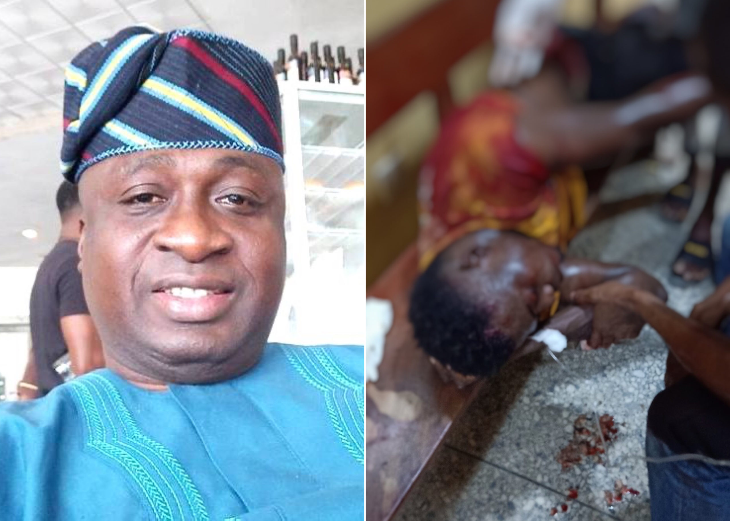 #EndSARS: Two Feared Dead As Politician Shoot At Peaceful Protesters At Abule Egba, Lagos