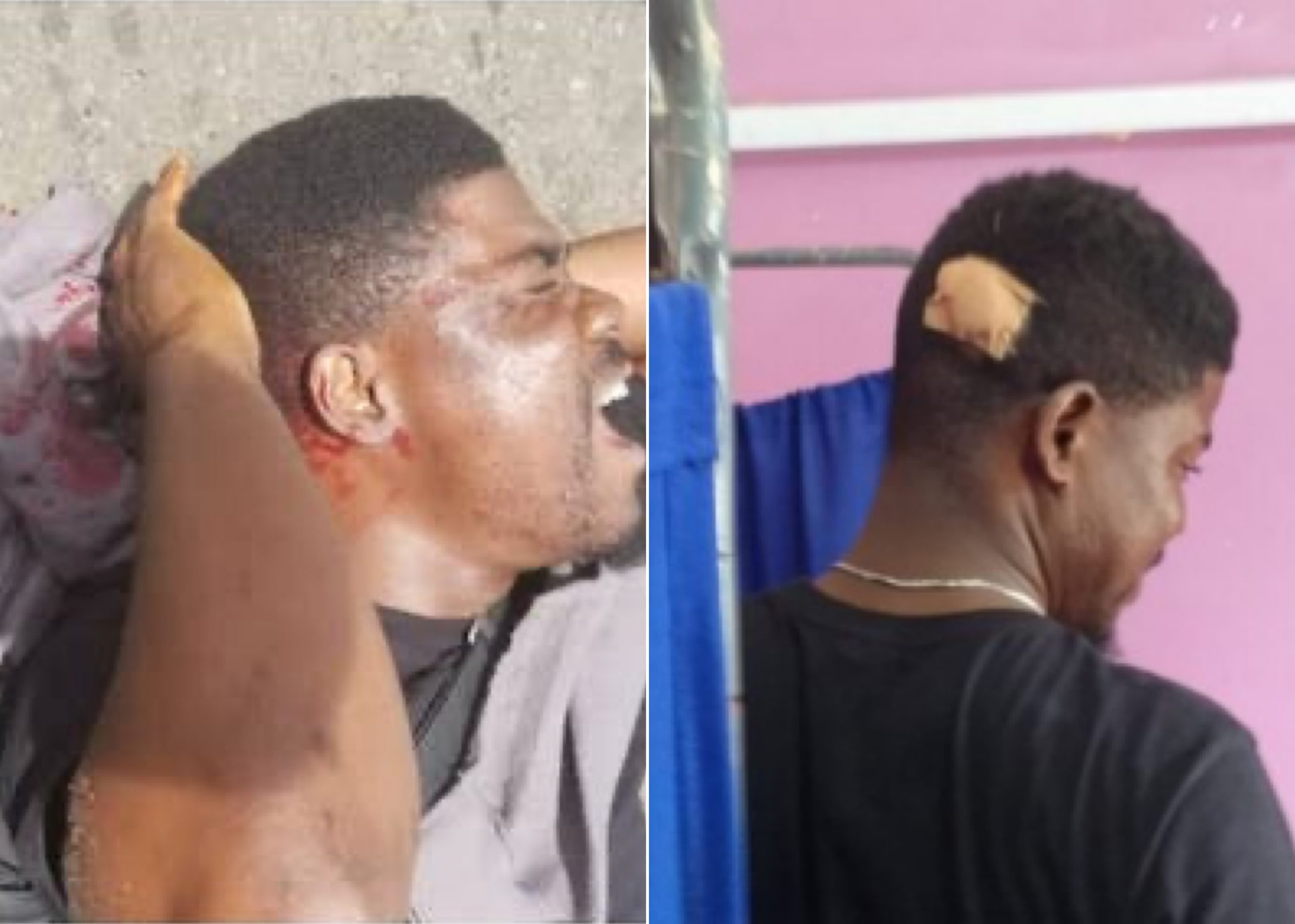 RevolutionNow: Police Brutalize Journalist At October 1 Protest In Lagos