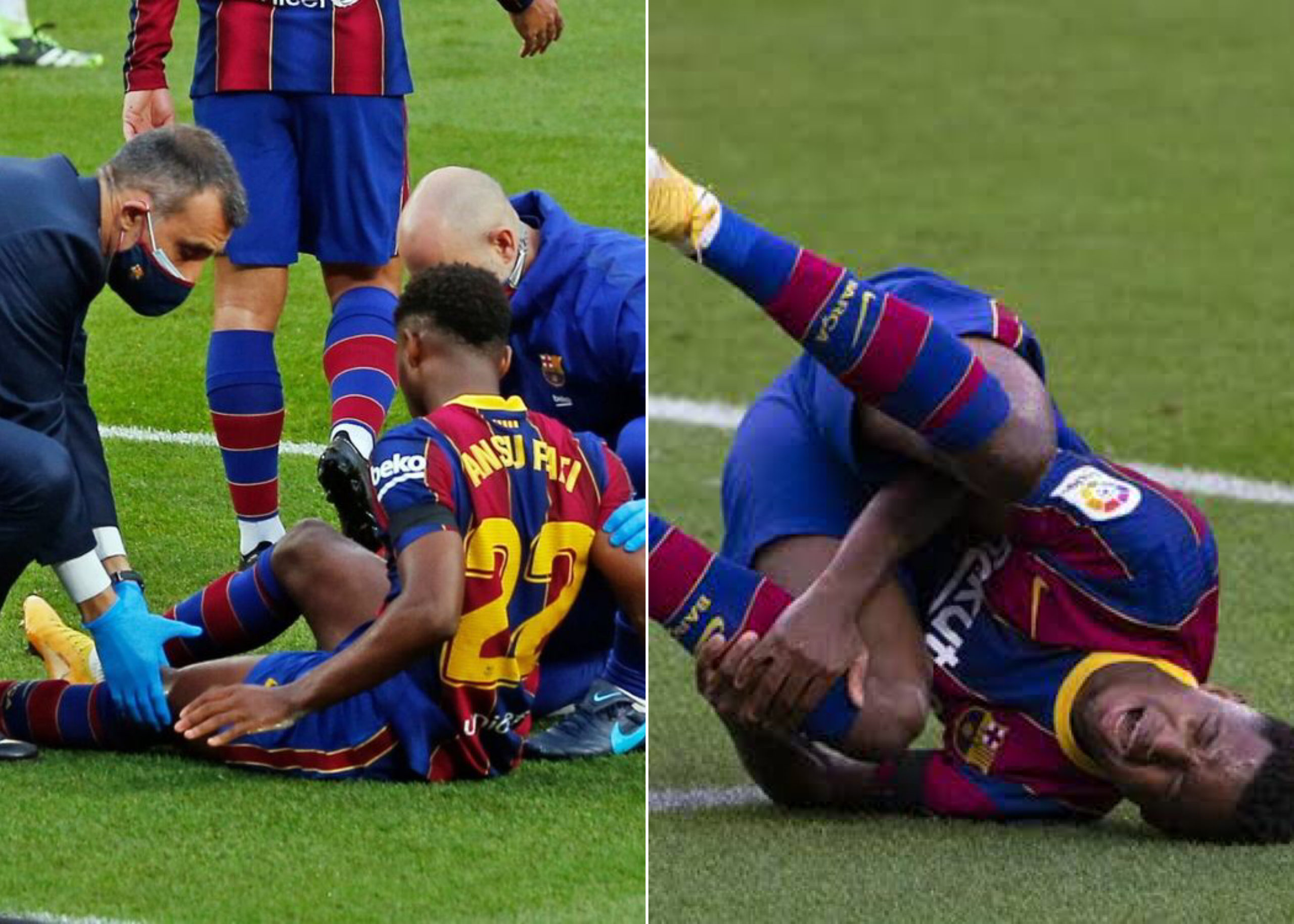 Barcelona‘s Ansu Fati To Undergo Knee Surgery On Monday