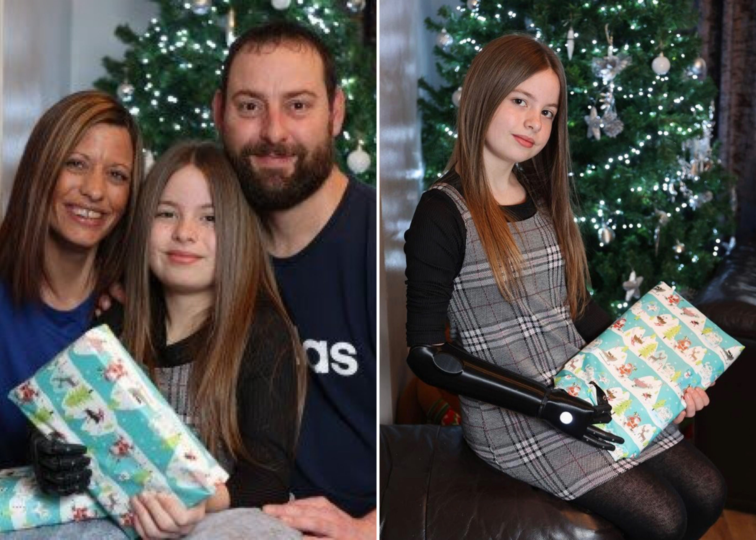 10-Year-Old Girl Born Without Right Hand Gets New Bionic Arm In Time To Open Christmas Presents
