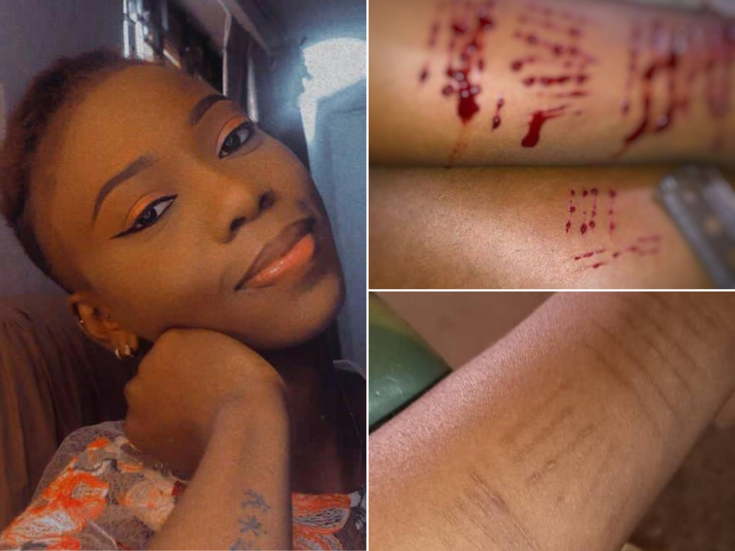 Lady Celebrates Two Months Of Being Free From Self-Harm