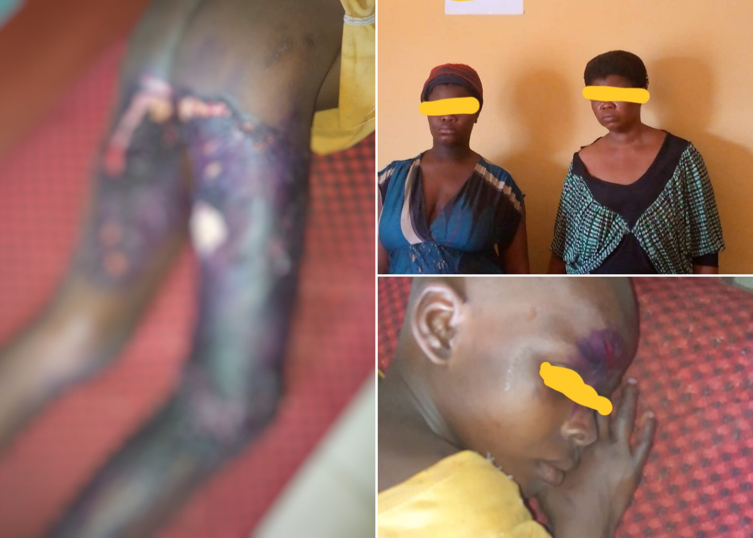 Two Women Arrested For Allegedly Pouring Hot Water On Their 10-Year-Old Maid In Anambra
