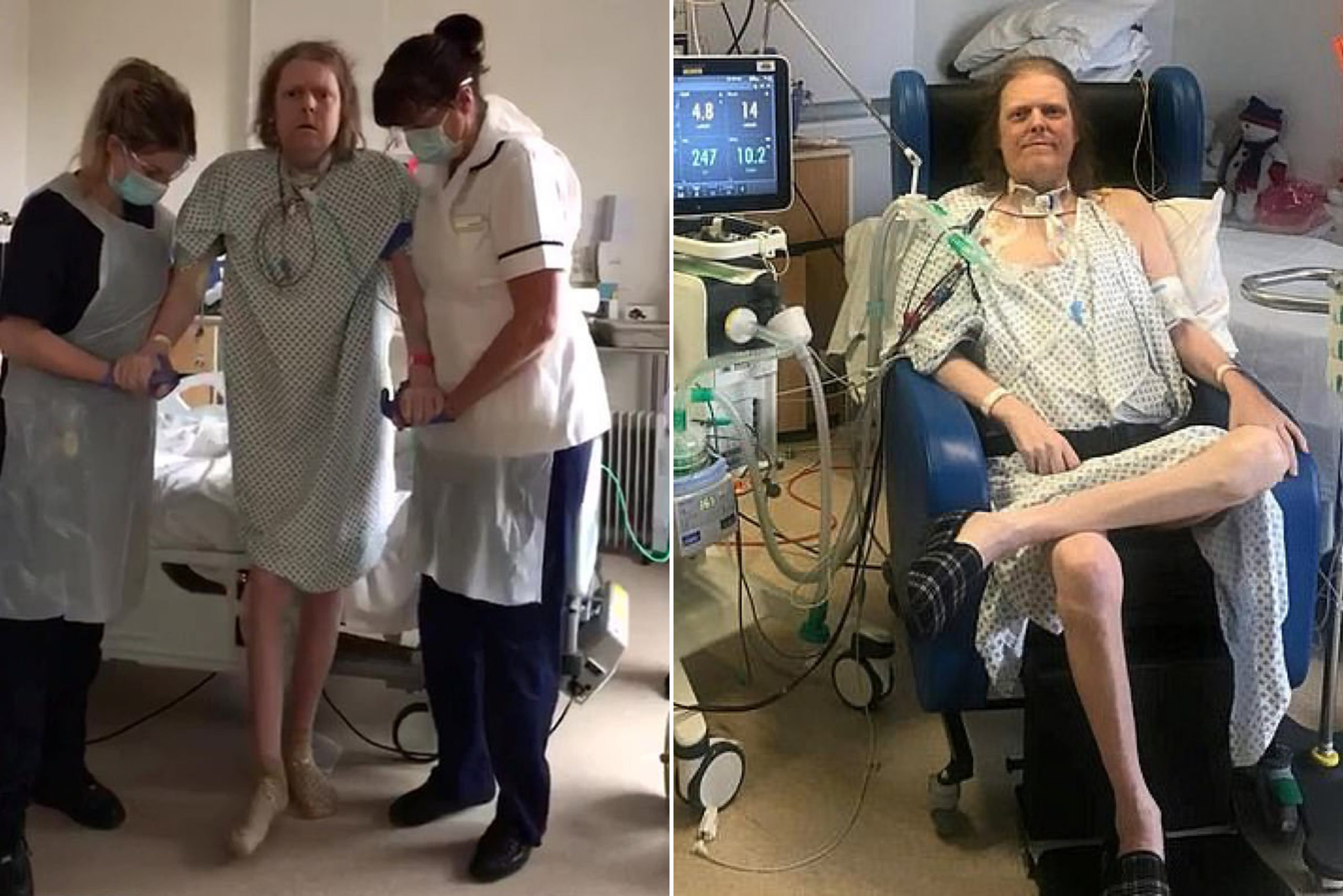 One Of UK’s Longest-Suffering COVID-19 Patient Takes His First Steps Since March
