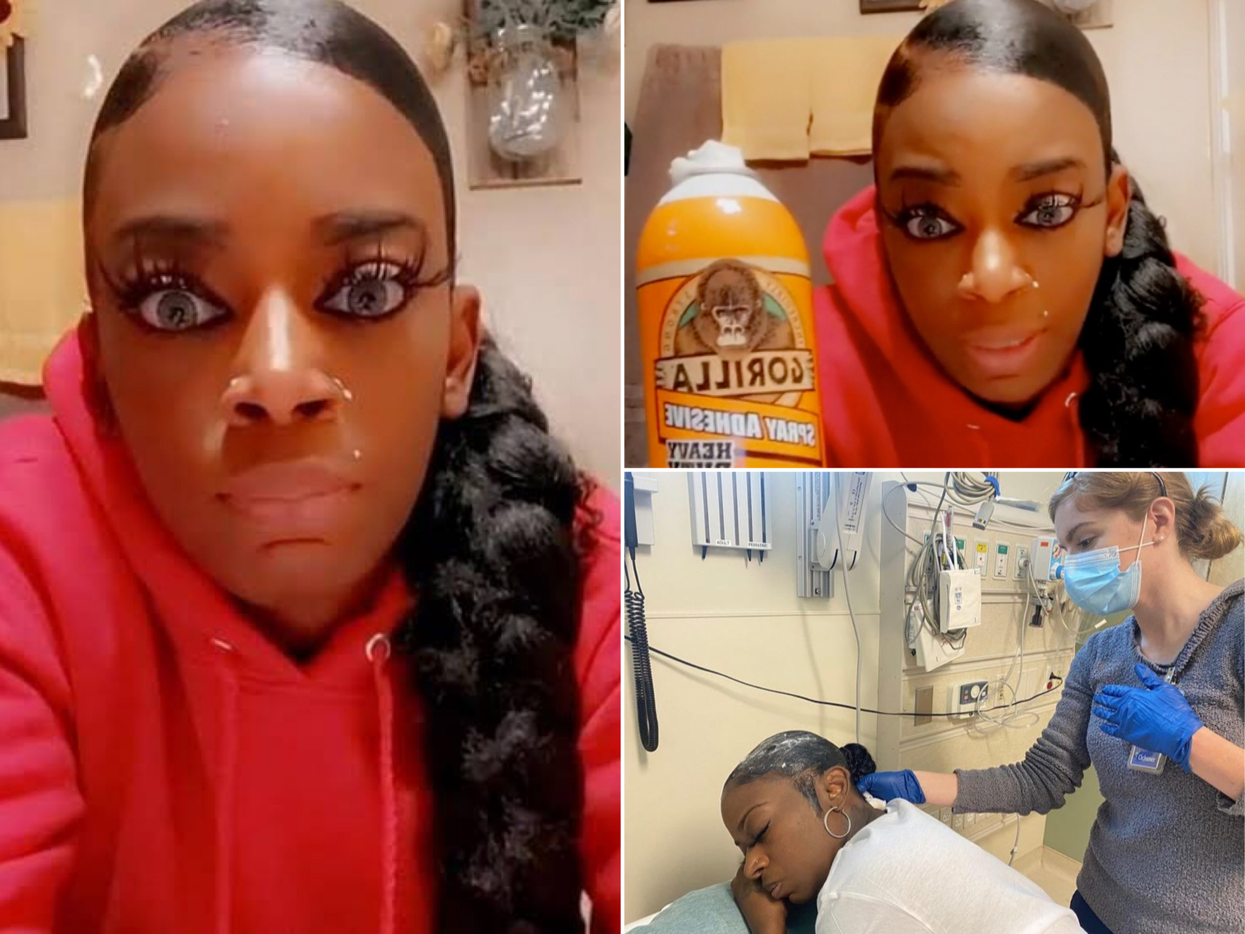 #GorillaGlueGirl: Lady Applies Permanent Glue To Hair, Seeks Medical Treatment