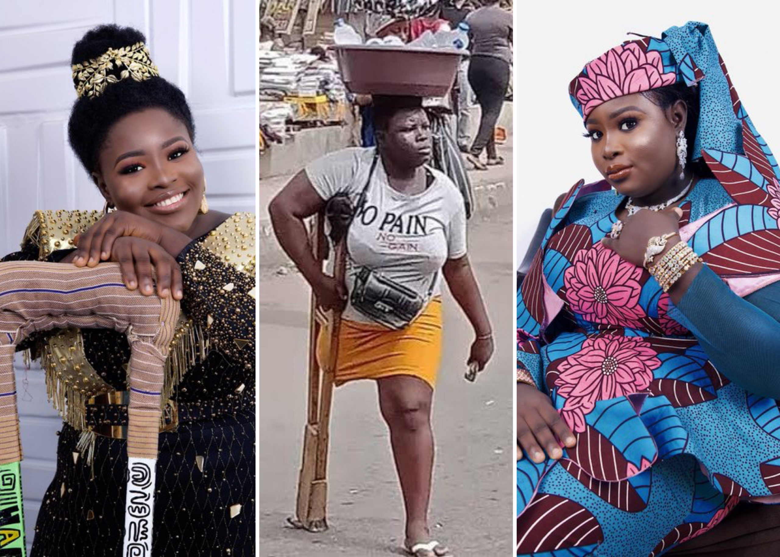 Amputee Woman, Who Went Viral For Hawking Despite Disability, Shares Amazing Transformation Photos To Mark 27th Birthday
