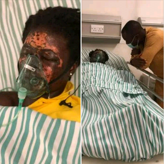 Man Bathes Wife With Acid In Ghana