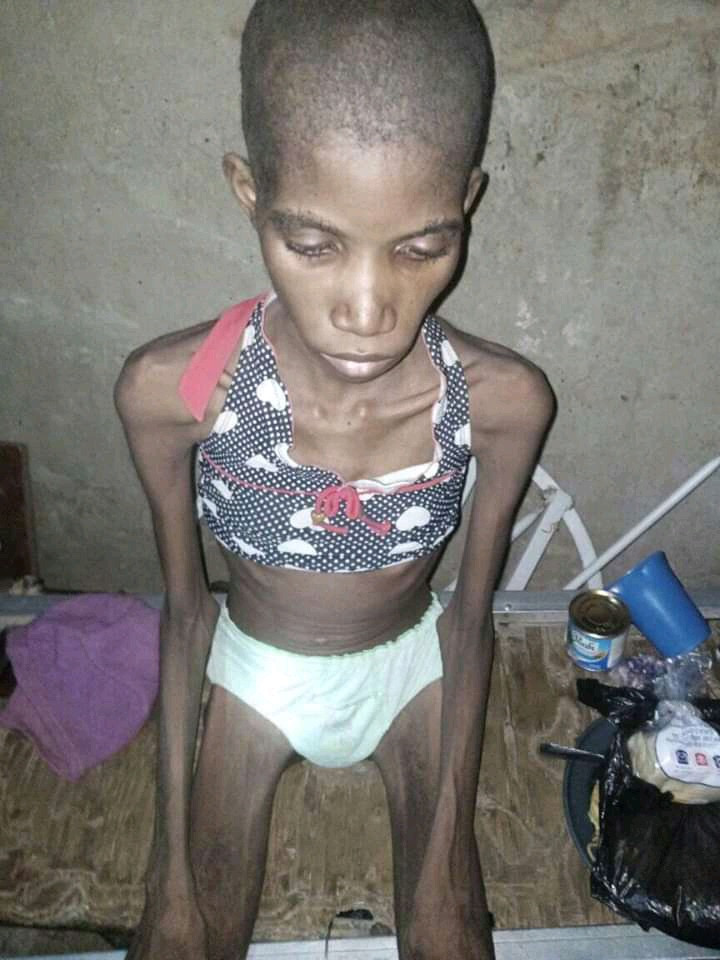 Sokoto Police Rescue 12-Year-Old Girl Caged, Starved For 8 Months