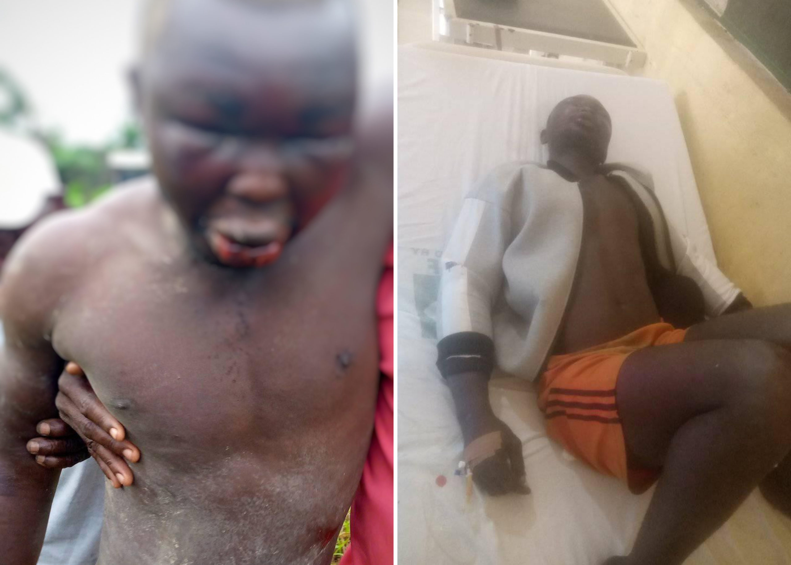 Man Found Alive In Bayelsa Forest With Hands, Legs Tied