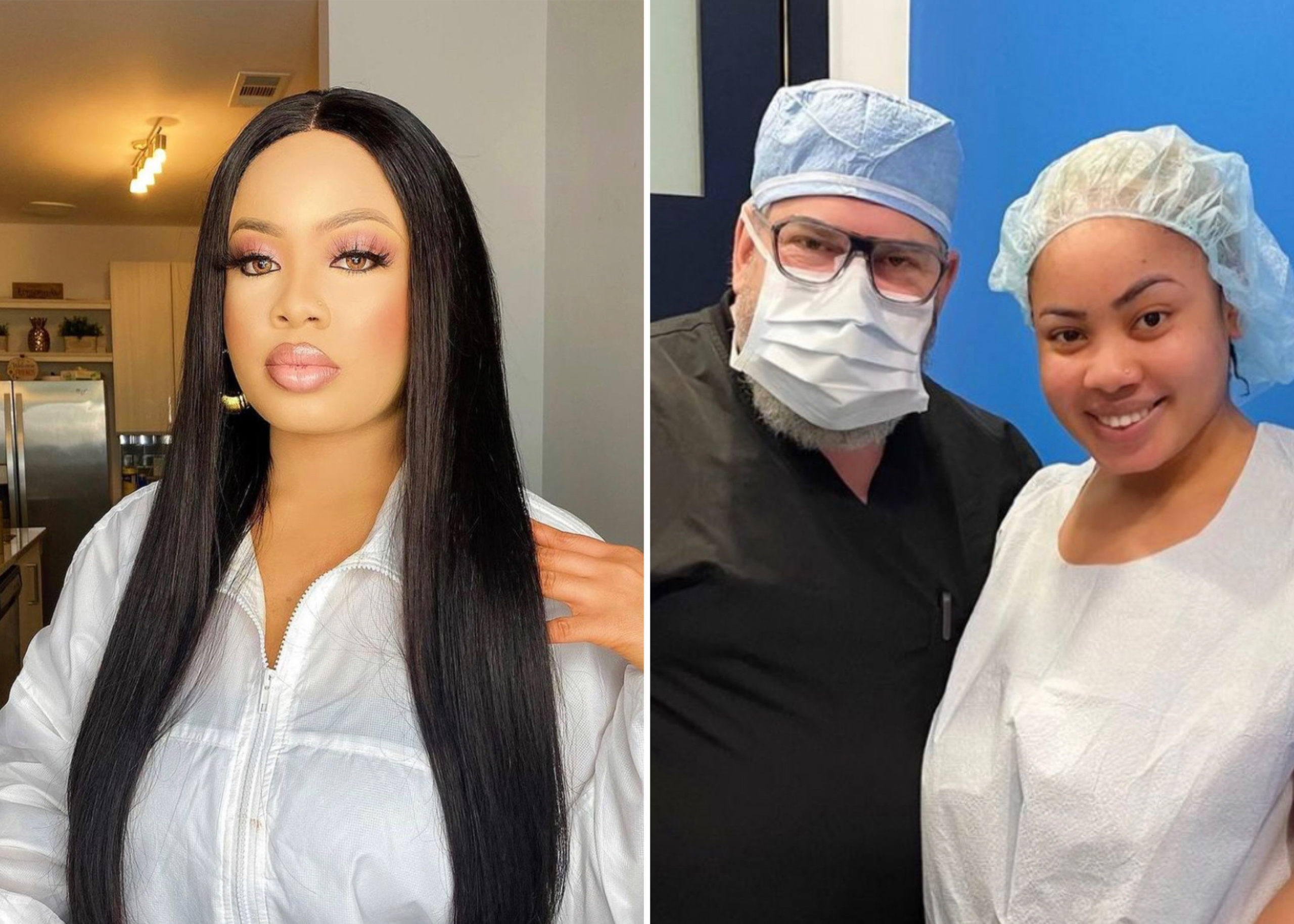 Reality TV Star, Nina Ivy Undergoes Plastic Surgery