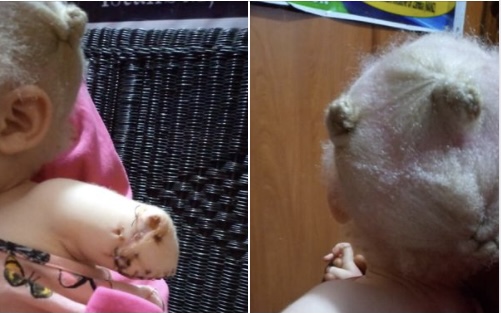 2-Year-Old Girl’s Hand Chopped Off By Albino Hunters Pretending To Be Policemen