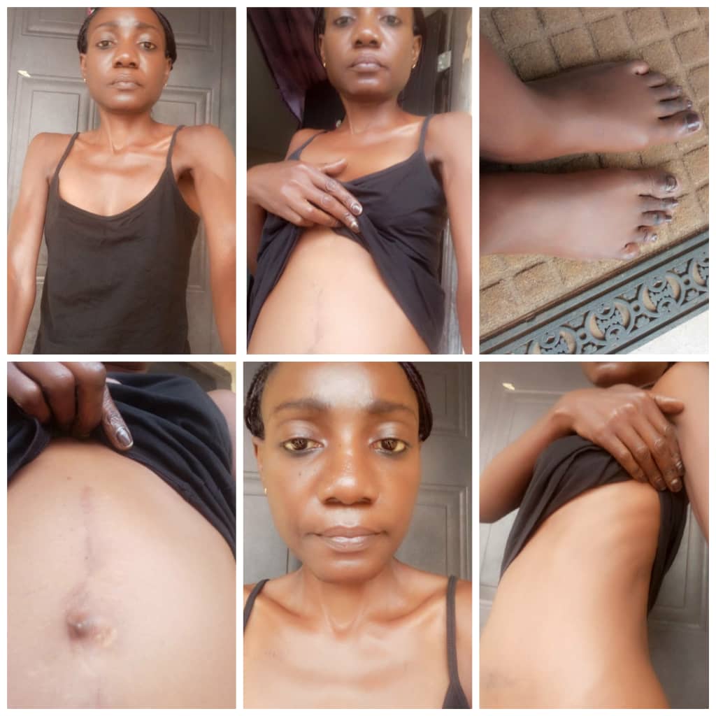 A Cry For Help!: Journalist, Laura Nduoyo Needs Financial Assistance To Stay Alive