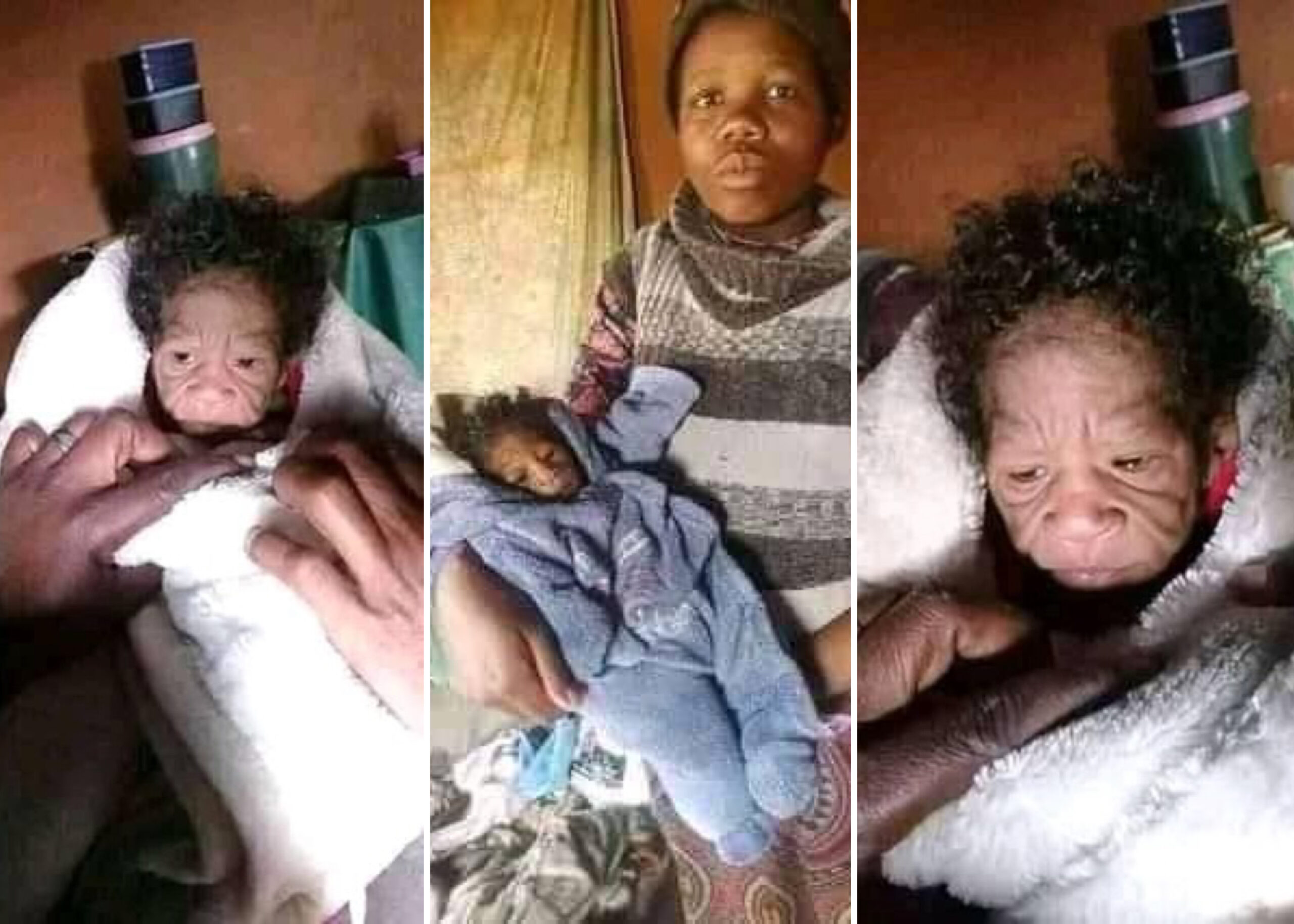 20-Year-Old South African Lady Gives Birth To Baby Girl With Rare Genetic Condition Known As Progeria