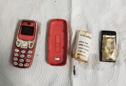 Man Swallows Nokia 3310 Phone, Undergoes Surgery For Removal
