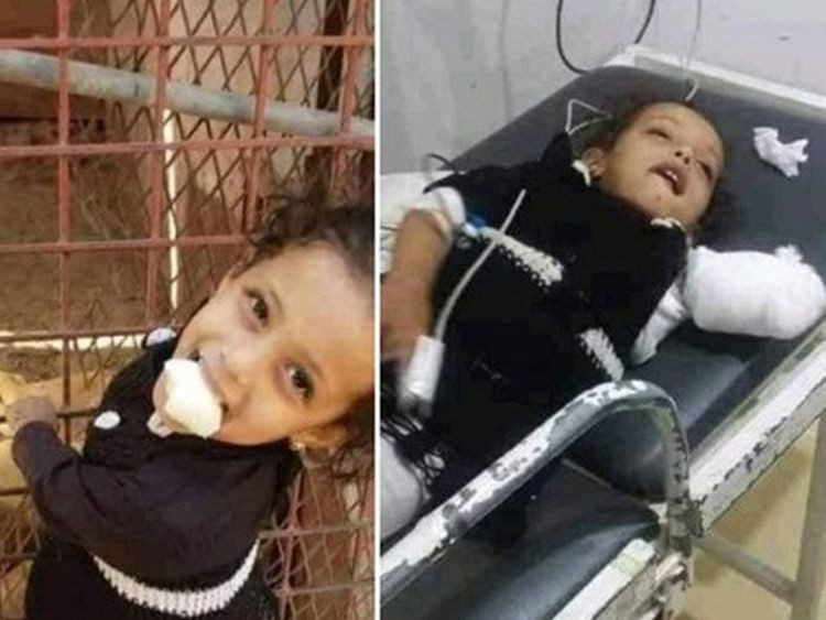 Lion Bites Off 2-Year-Old Girl’s Hand In Yemen Zoo