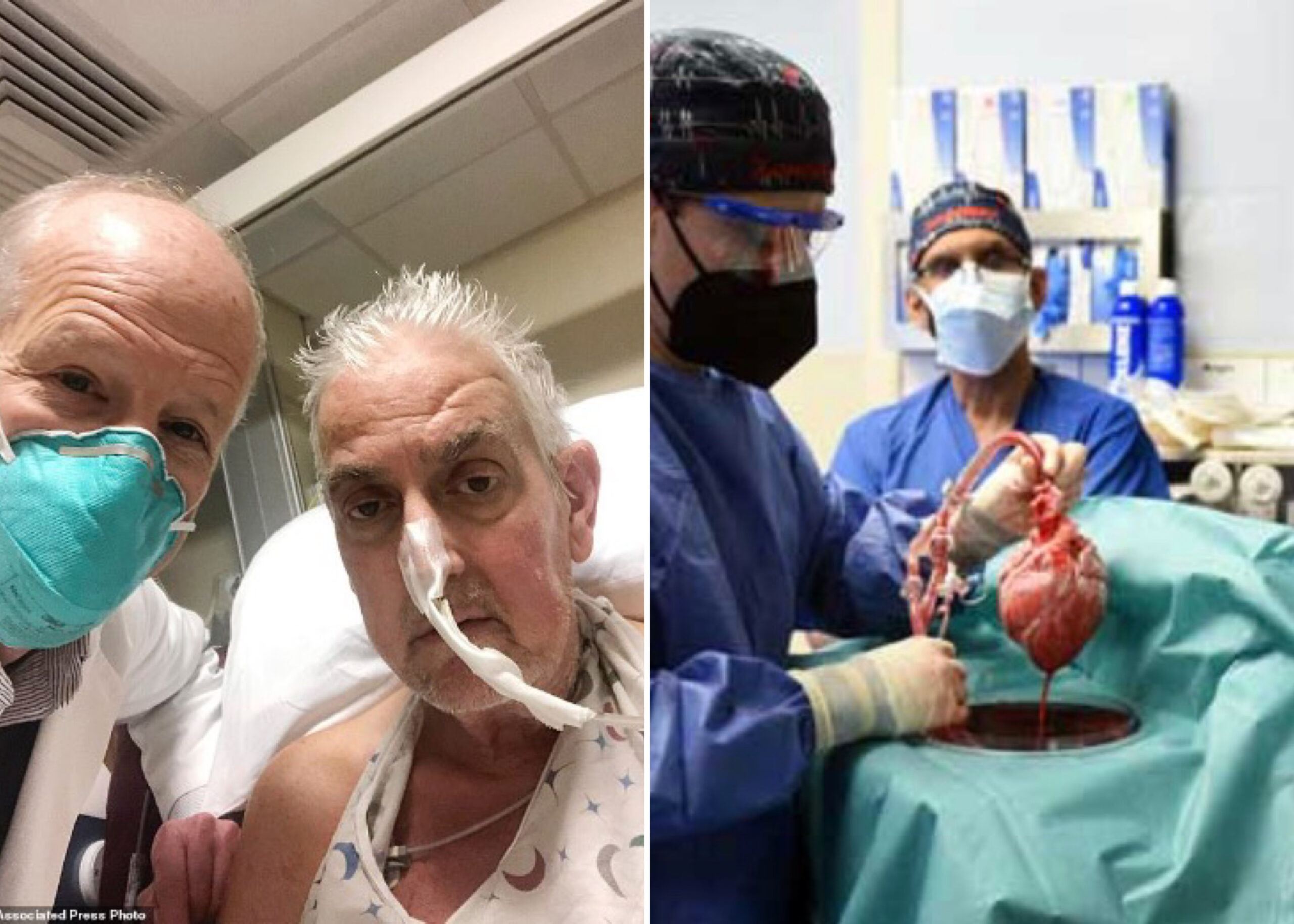 US Man Who Got First Pig Heart Transplant Dies 2 Months After Surgery
