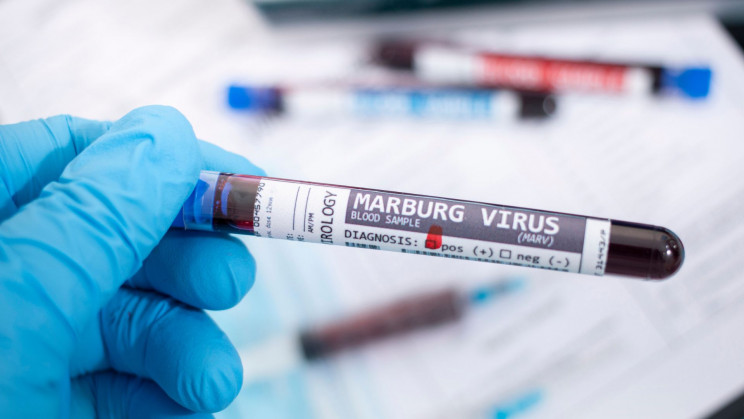 marburg virus